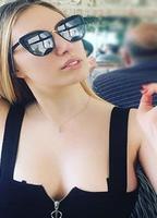 Yasmin erbil estetiksiz
