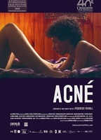 Acné (2008) Nude Scenes