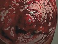 clip-Trapped Ashes-Phoebe